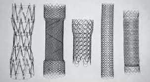 Due to the stent design (low radial force and lack of columnar support), significant risk of. Stent Models Left To Right Colonic Z Cook Evolution Colonic Download Scientific Diagram