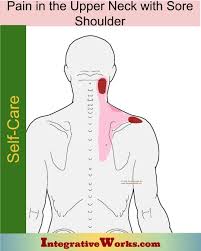 Pin On Neck Trigger Point Pain