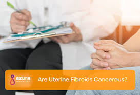 Understanding Uterine Fibroid Size How Big Is Too Big