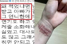 실시간 전 aoa 멤버 권민아 인스타.jpg. ê¶Œë¯¼ì•„ Aoa ì§€ë¯¼ ì—ê²Œ ì†ëª© ì‚¬ì§„ ë³´ë‚´ë©° í•œ ë§ ìœ ê²½ ì¸ìŠ¤íƒ€