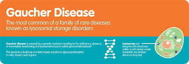 Gaucher Disease An Interview With Dr Clement Olivier Shire
