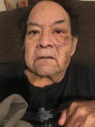 Frank Aguirre Obituary