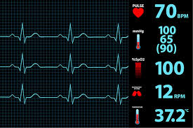 Vital Sign Alert Vsa Device A Novel Device For Use In