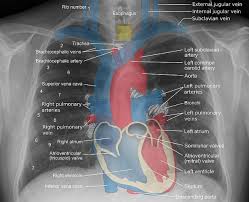 Terms are defined in reference to a theoretical person who is standing in what is called anatomical position (see figure below): Anatomy For Radiology Chest Glass Box