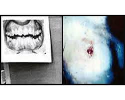 Graphic Content: Ted Bundy Crime Scene Photos