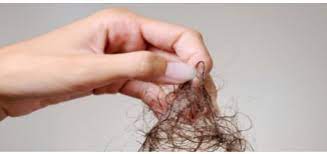 That's a women's health condition that affects your hormone levels. Telogen Effluvium My Hair Doctor Prescription Haircare
