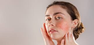 Image result for erysipel photos)