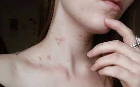 This is one of the five warning signs of breast cancer: 8 Possible Signs Of Cancer That You Just Shouldn T Ignore Lifestyle News