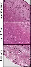 Check spelling or type a new query. Hyaline Cartilage Wikipedia