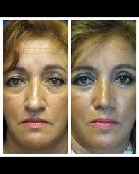 Instagram photo by Dr. Mario Botero Ramirez • May 3, 2024 at 7:37 PM