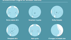 Generally, symptoms of breast cancer. Rare Signs Of Breast Cancer