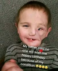 Today is my birthday and so far no one as wished me happy birthday because  of my condition so sad 😭😭