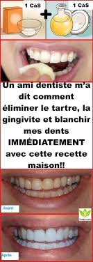 Pin On Besoin
