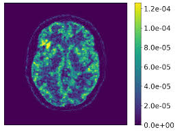 Supplementary Materials : Nonparametric posterior learning for emission  tomography with multimodal data