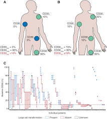 Check spelling or type a new query. Response To Brentuximab Vedotin Versus Physician S Choice By Cd30 Expression And Large Cell Transformation Status In Patients With Mycosis Fungoides An Alcanza Sub Analysis European Journal Of Cancer