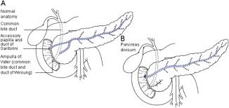 Accessory Pancreatic Duct An Overview Sciencedirect Topics