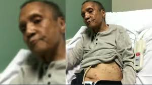 Woman says dad attacked by ants at VA before he died