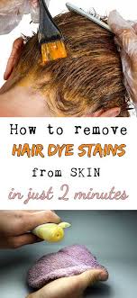 Most Creative And Life Changing Beauty Hacks Every Woman Needs To Know Hair Dye Removal Dyed Hair Hair Color Remover