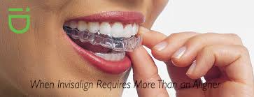 They are generally classified by the problem that is to be corrected. When Invisalign Requires More Than An Aligner Identity Orthodontics