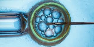 El diagnóstico genético preimplantacional (dgp) es el estudio de alteraciones cromosómicas. Que Es El Diagnostico Genetico Preimplantacional 2021 Mujer Fertil