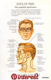 1940s What Might Be Causing Your Headache Health Pinterest Migraine Headache Relief And Headache Remedies 19 Headache Types Migraine Headache Remedies