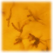 Aureobasidium Machado Environmental
