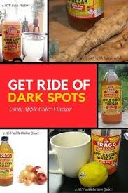 Get Rid Of Dark Spots Using Apple Cider Vinegar Dark Spots Remedies Apple Cider Dark Spots An entire bottle of apple cider vinegar is not often used in one sitting, which may leave you wondering whether it ever expires. get rid of dark spots using apple cider
