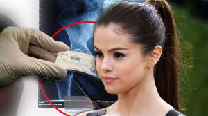 Aug 24, 2019 · born on 22 nd of july in the year 1992, selena marie gomez, is an american origin singer, actor, songwriter along with a producer. Selena Gomez Zusammenbruch Ergebnis Von Bluttest Sorgt Fur Riesen Schock Fanbase