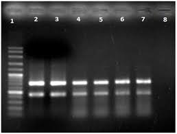 We are johnson & associates, p.l.l.c. Multiplex Pcr In Determination Of Opiinae Parasitoids Of Fruit Flies Bactrocera Sp Infesting Star Fruit And Guava