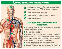 как лечить сужение сосудов головного мозга в домашних условиях Anevrizmy Perifericheskih Arterij Obshie Svedeniya O Zabolevanii I Ot Chego Voznikaet Bolezn Nemedikamentoznaya Terapiya I Metody Diagnostiki