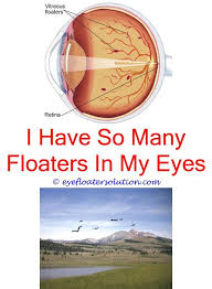 Eye Floaters When Tired Large Eye Floaters Causes How To Live With Floaters In The Eye Can What Causes Eye Floaters Eye Floaters Treatment Eye Floaters Cure