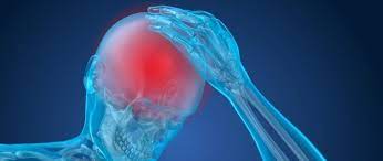 Post Concussion Syndrome Car Accident Settlements Car Accident Settlement Carey Leisure Neal