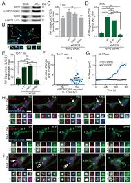 The reward system in happy glass depends on how much of the pen tool you'll use. Expression Of Wipi2b Counteracts Age Related Decline In Autophagosome Biogenesis In Neurons Elife
