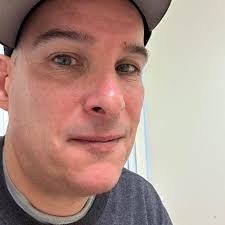 Is bleeding normal when applying Dexcom G7 sensor