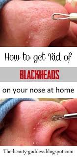 3 exfoliating to clean your pores. How To Remove Deep Blackheads Beauty Deep Blackheads Blackheads On Nose Blackheads