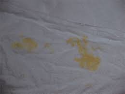 Vomiting In Neonates Better Safer Care