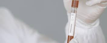 Auch nicht als zutrittsnachweis anerkannt werden. Corona Tests 1010 Wien Ab 29 Dermacare Wien