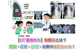 務 營養照護服務 氣喘疾病管理 傷口造口服務 安寧共同照護 移植小組照護 愛滋病疾病管理 結核病個案管理 腫瘤個案管理 醫療品質暨滿意度調查 優良. Https Xn O1qq22cjlllou16giuj Jp Archives Tag E7 B5 90 E6 A0 B8