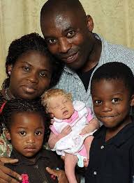 ((secrets of ancient egypt page on. This Black Nigerian Couple Have Somehow Given Birth To A White Baby Social Gazette