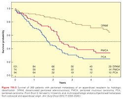 Check spelling or type a new query. Peritoneal Metastases And Peritoneal Mesothelioma Oncohema Key