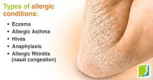 Pin On 34 Menopause Symptoms