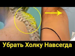 как избавиться от горба на спине в домашних условиях Holka Shishka Na Shee Kak Izbavitsya Youtube V 2020 G Tovary Dlya Zdorovya Trenirovka Dlya Talii Domashnie Uprazhneniya