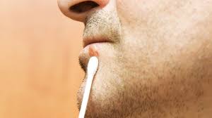 Selbstmedikation Finger Weg Vom Herpes