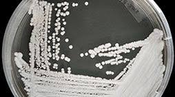 Image result for Buchnera candida