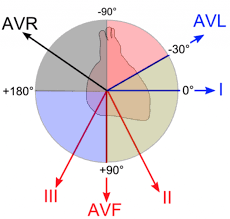 Ecg Basics Rebel Em Emergency Medicine Blog