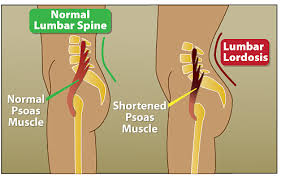 Lie flat on your back on a stable bench or on your bed. Psoas Talk With Christye Volt Blog