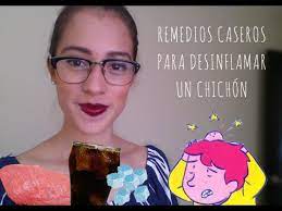 Como Quitar Un Chichon En La Frente Actualizado Diciembre 2021