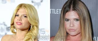 Explore chanel west coast's music, music videos, and innermost thoughts. Chanel West Coast Plastic Surgery Photos Verge Campus