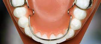 Maybe you would like to learn more about one of these? Update Info Terbaru Tarif Pasang Gigi Palsu Permanen Dan Lepasan Daftar Harga Tarif