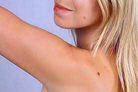 If there are lots of. How Can I Tell If I Have Skin Cancer Dermatologist In Lincoln Ne Strnot Dermatology